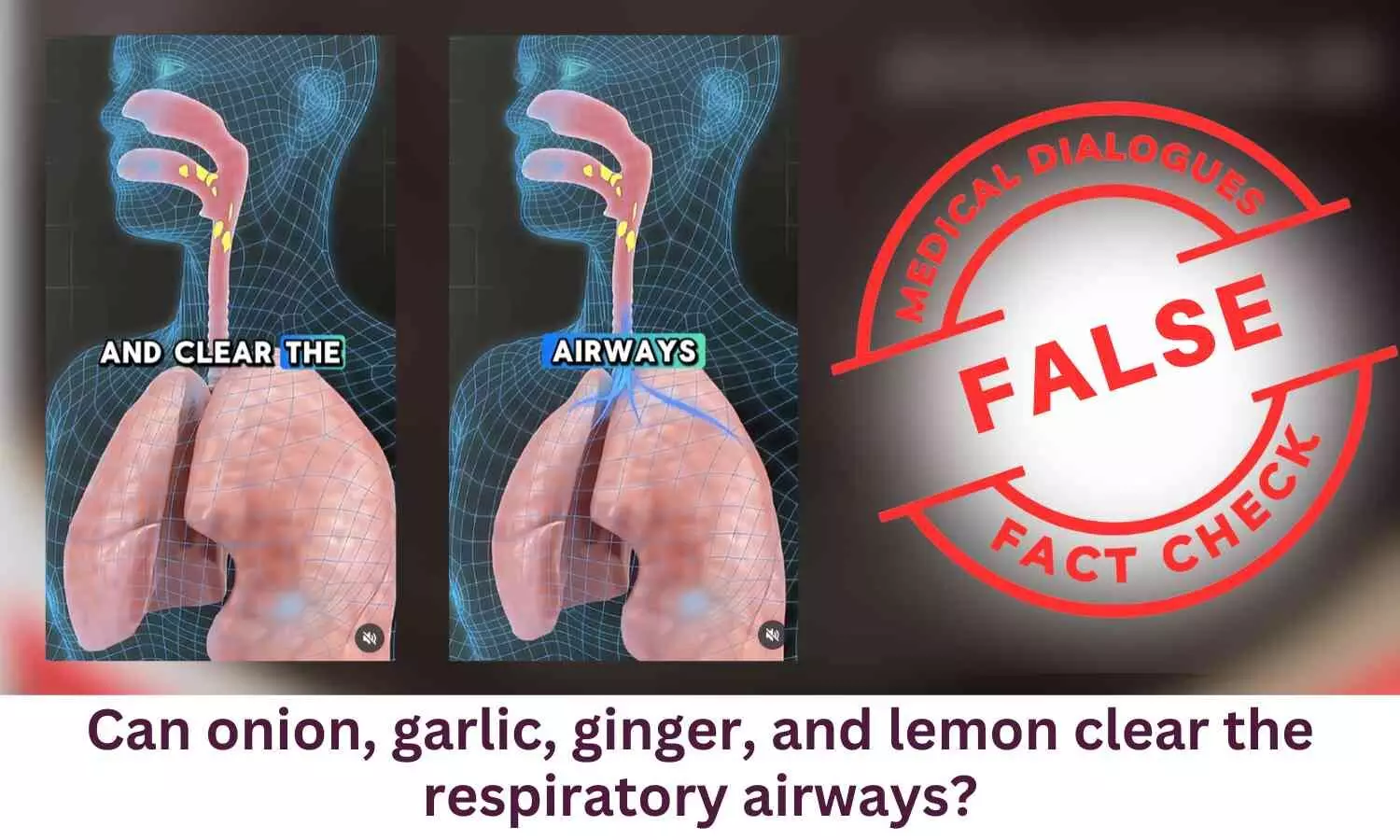 Fact Check: Can onion, garlic, ginger, and lemon clear the respiratory airways?
