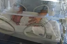 Autologous umbilical cord blood cells Safe but Show No Early Neurodevelopmental Benefit in Preterm Infants: JAMA