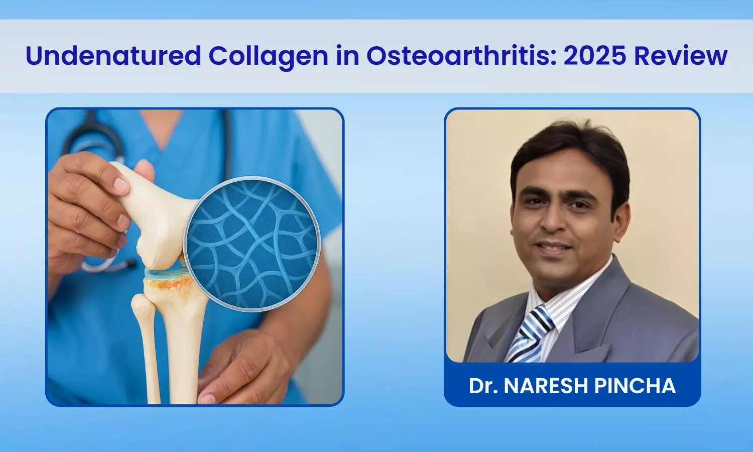 Undenatured Collagen in Osteoarthritis Management: Practitioner's Review in 2025