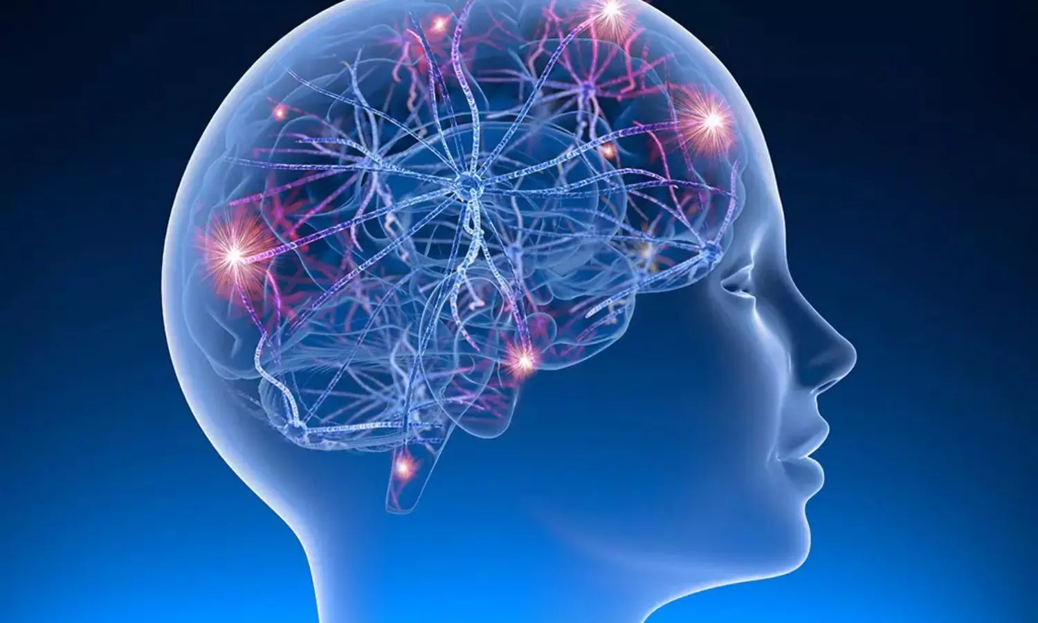 Magnetic Seizure Therapy Preserves Cognition and Reduces Suicide Risk in Adolescent Depression: Study