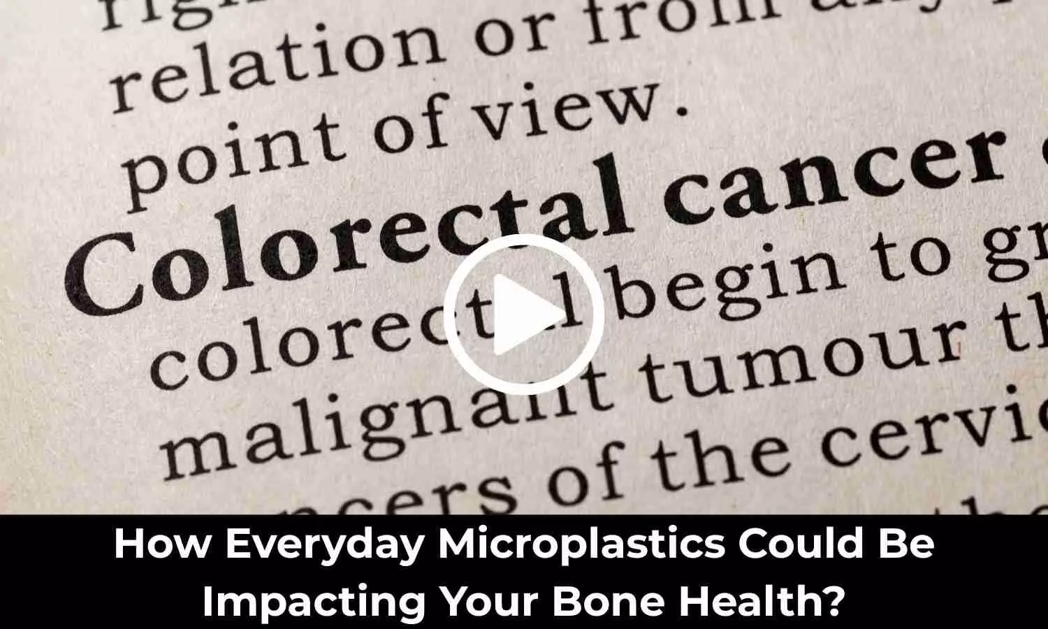This Simple Test May Detect 90 Percent of Colorectal Cancers: Study Suggests