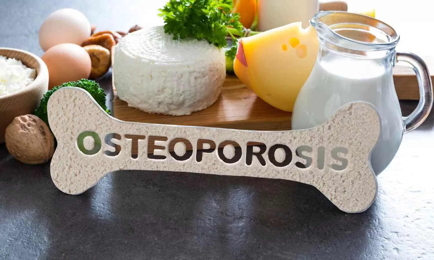 High Triglyceride-Glucose Body Mass Index Linked to Increased Osteoporosis Risk, Study Shows