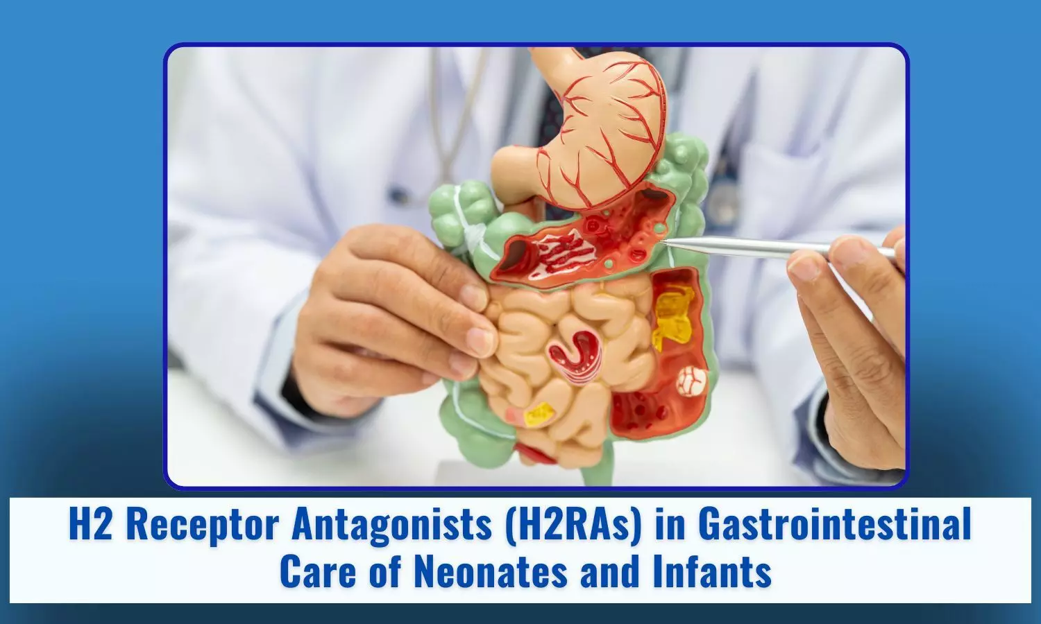 H2 receptor antagonists (H2RAs) in Gastrointestinal Care of Neonates and Infants: Indian Paediatricians' Perspectives