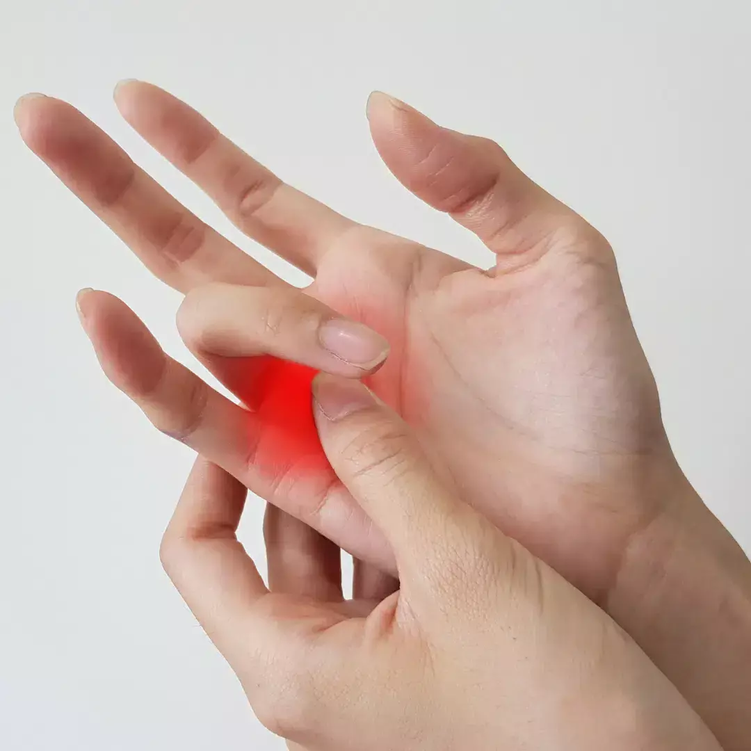 Percutaneous A1 Pulley Release Outperforms Steroid Injection in Improving Functional Mobility for Trigger Finger: Study