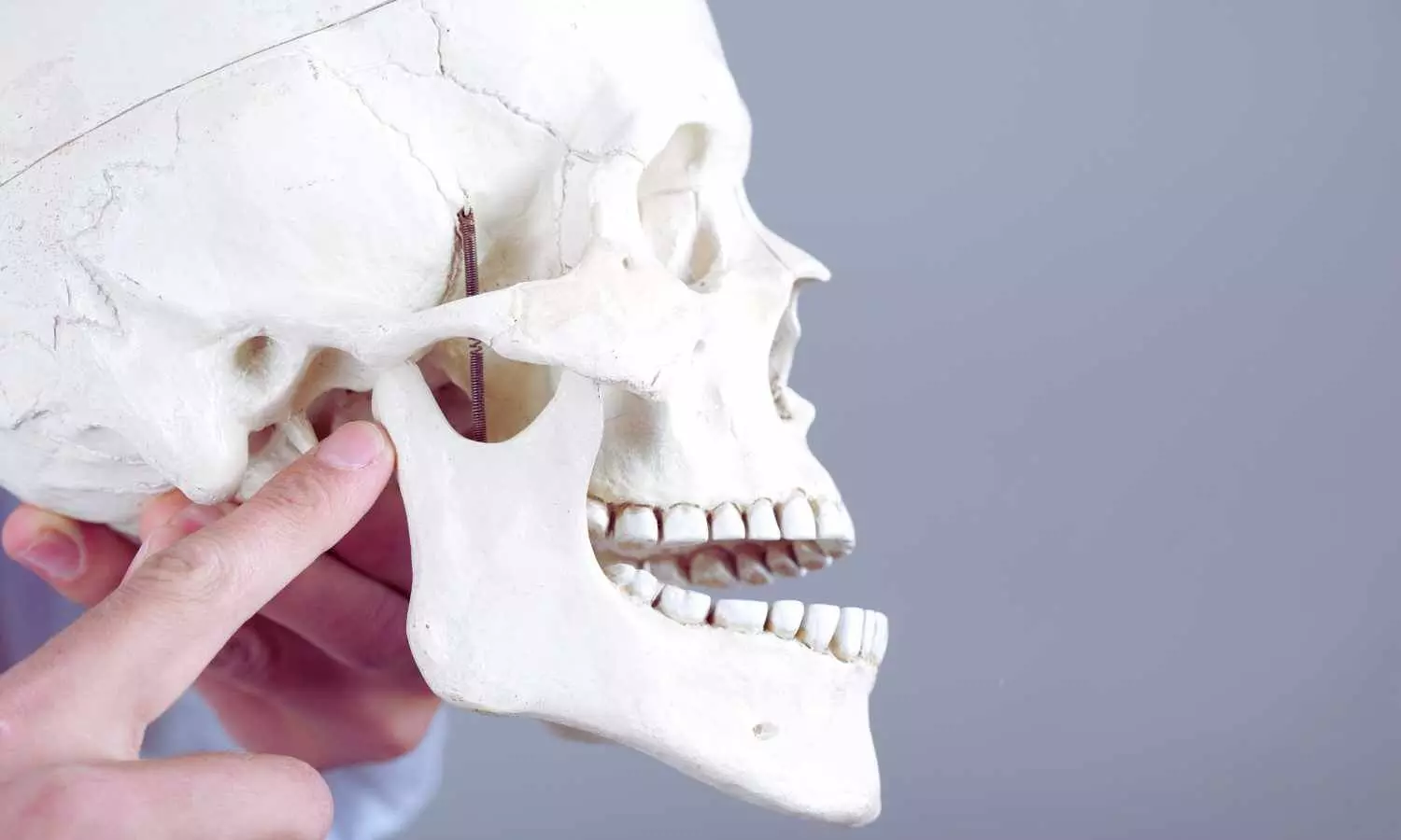 Mandibular Devices Effective for Severe Sleep Apnea with Hypertension: Study