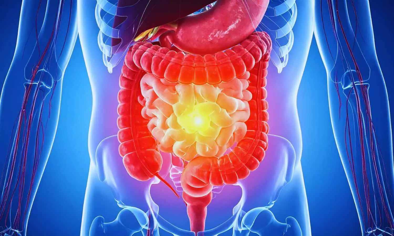 New Iron Supplement Combining Iron, Prebiotics, and Probiotics may Treat Anemia Without Causing Inflammation: Study