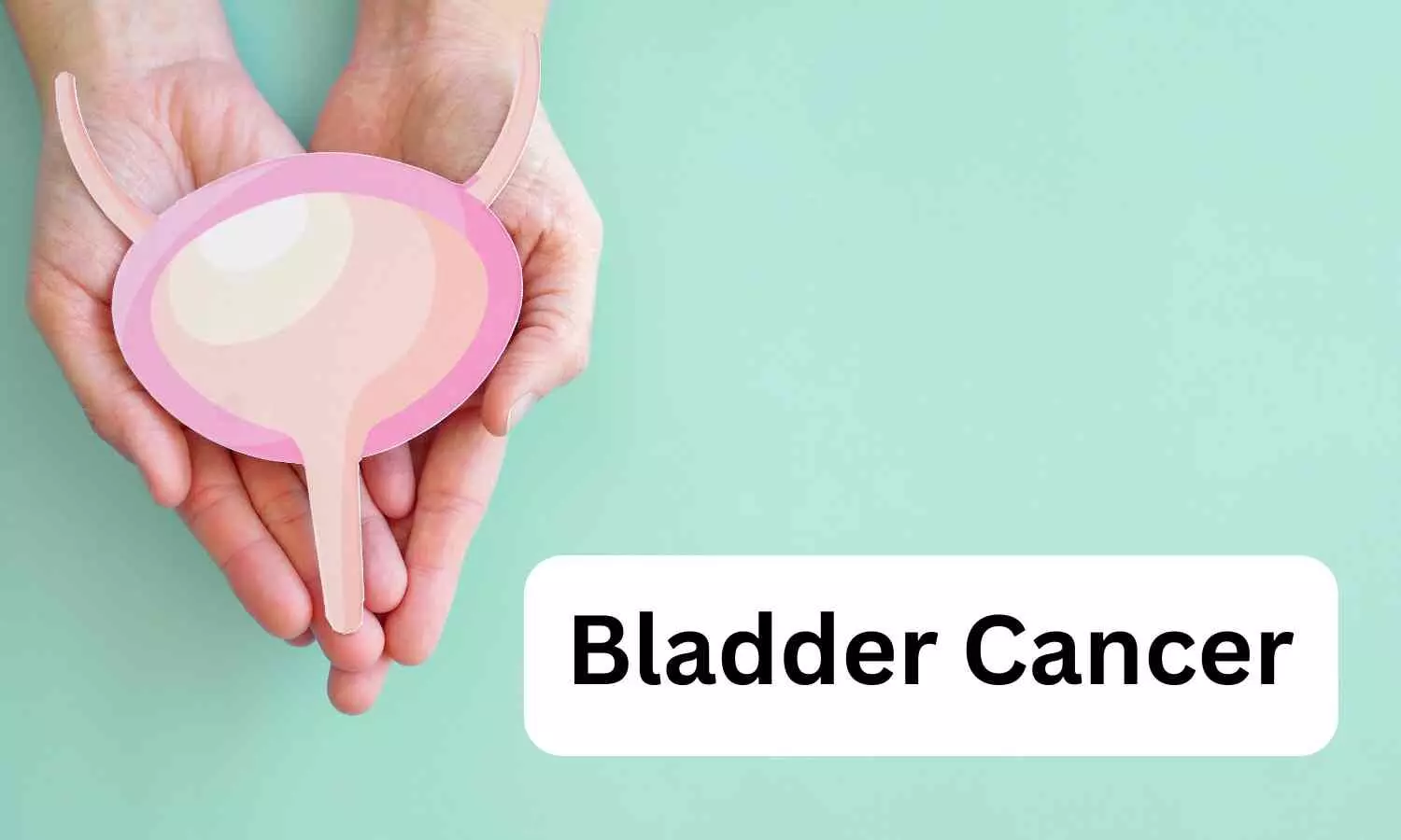 FDA Approves INLEXZO™ for BCG-Unresponsive Bladder Cancer