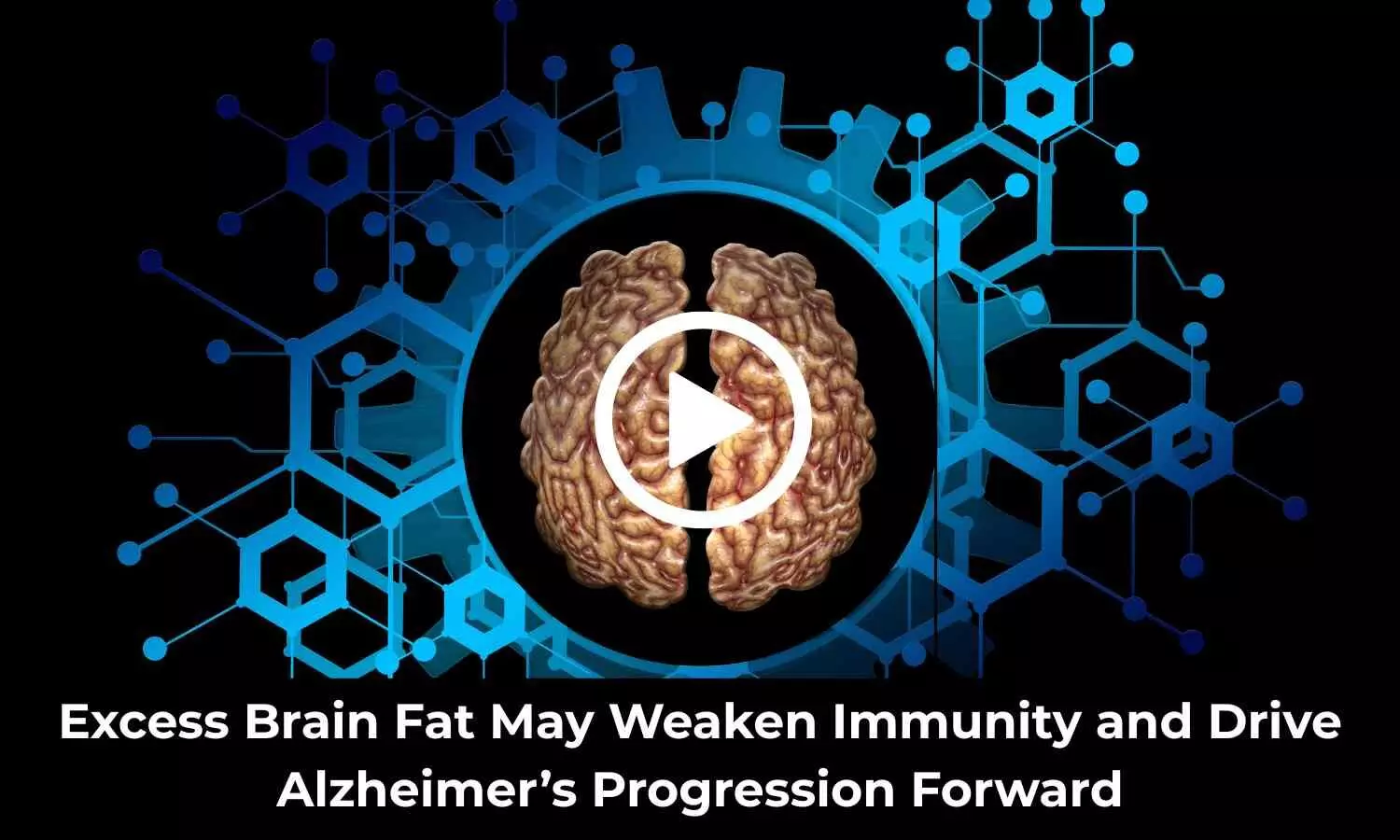 Excess Brain Fat May Weaken Immunity and Drive Alzheimer’s Progression Forward: Study Suggests