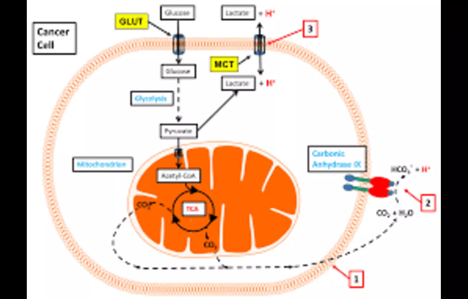 Carbonic anhydrase 3 protein in urine may be Potential Biomarker for ARAS: Study