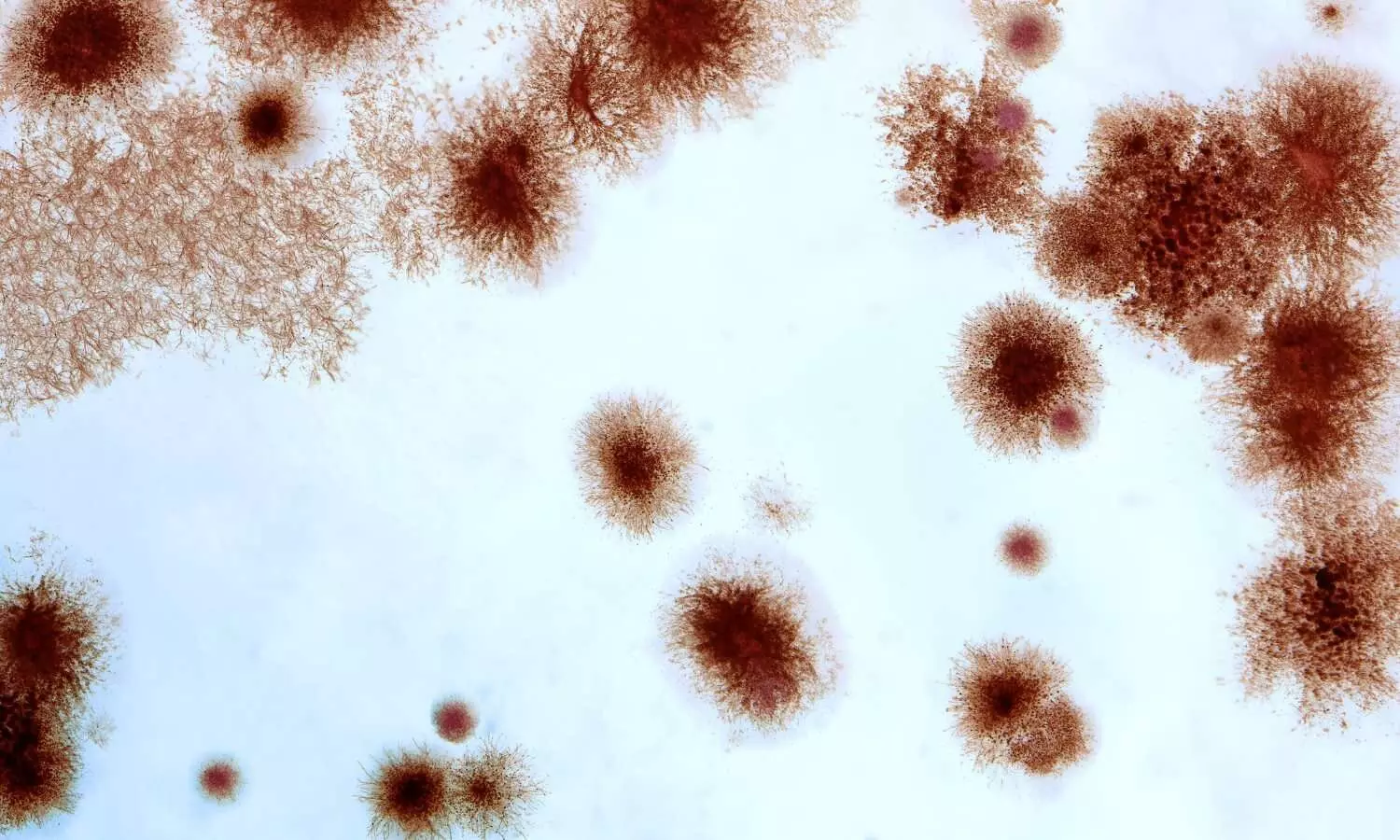 New test could speed detection of three serious regional fungal infections