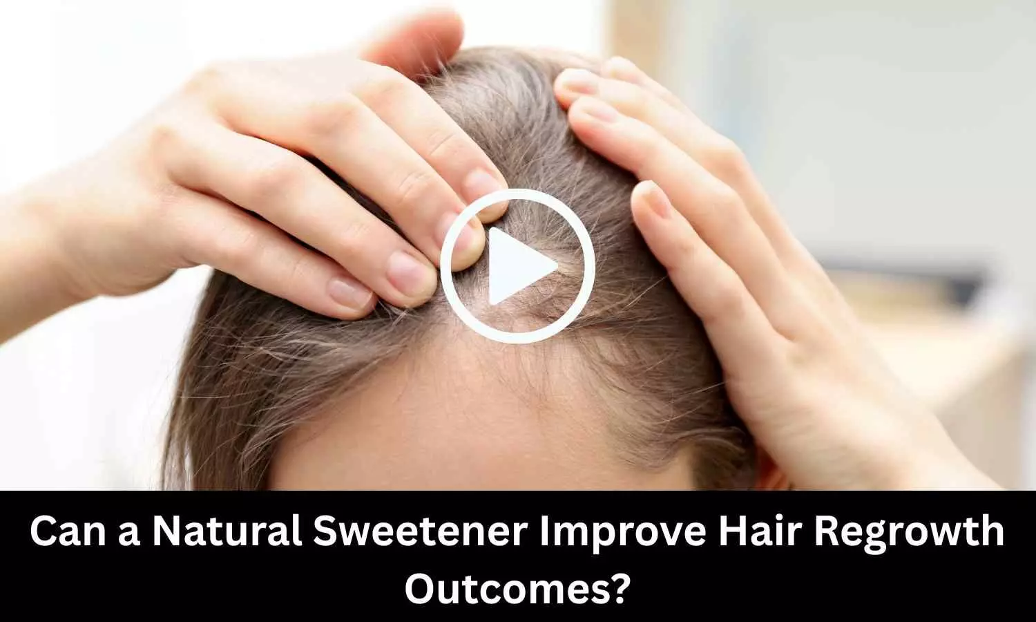 Can a Natural Sweetener Improve Hair Regrowth Outcomes? Study Provides Insights