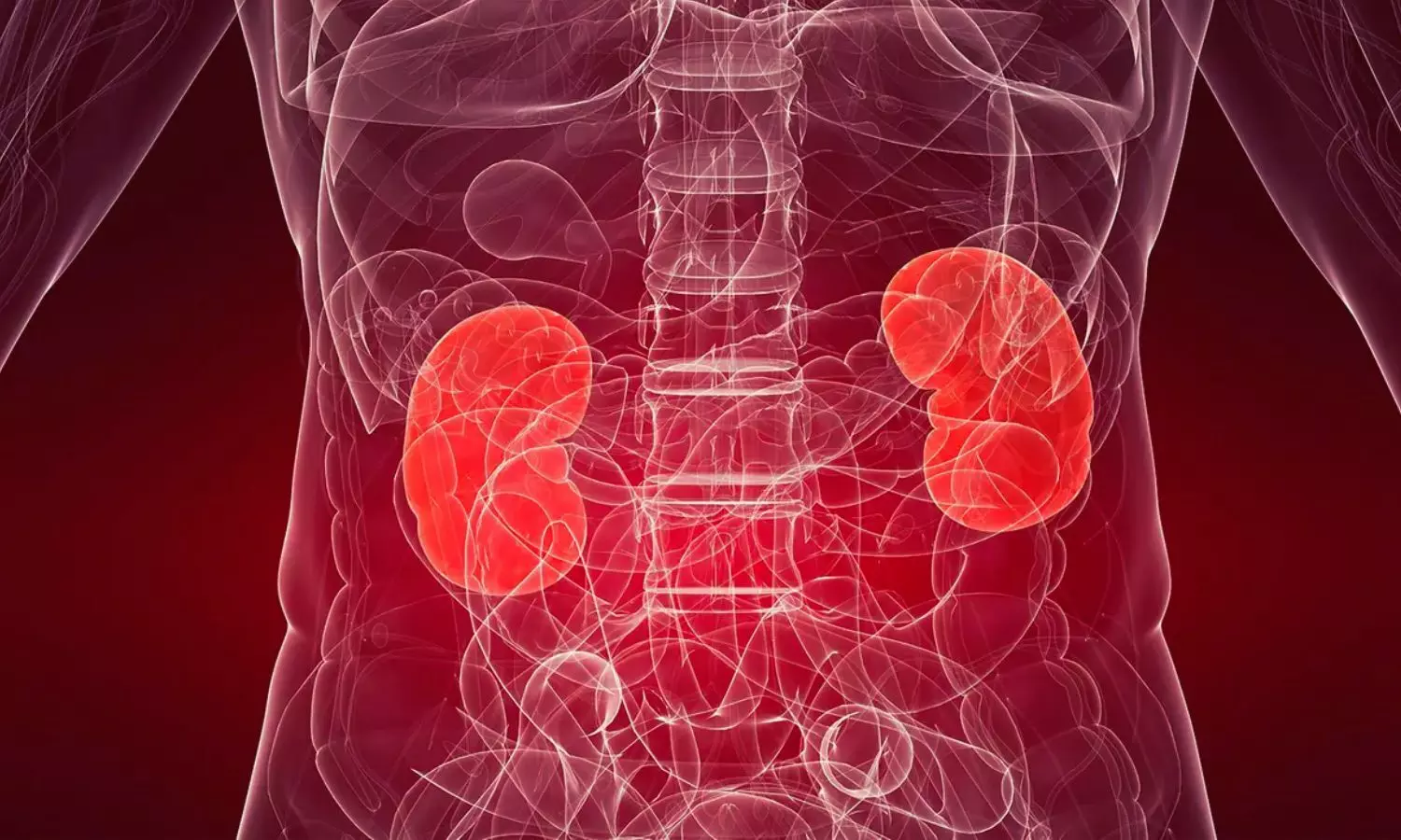 Vancomycin Linked to Higher AKI Risk in ICU Patients: Study