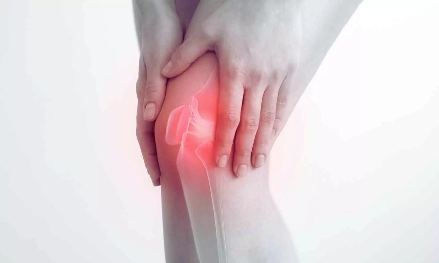 Modi Mundipharma Gets SEC Approval to Study Cingal, a Hyaluronic Acid-Steroid Device for Osteoarthritis Knee Pain