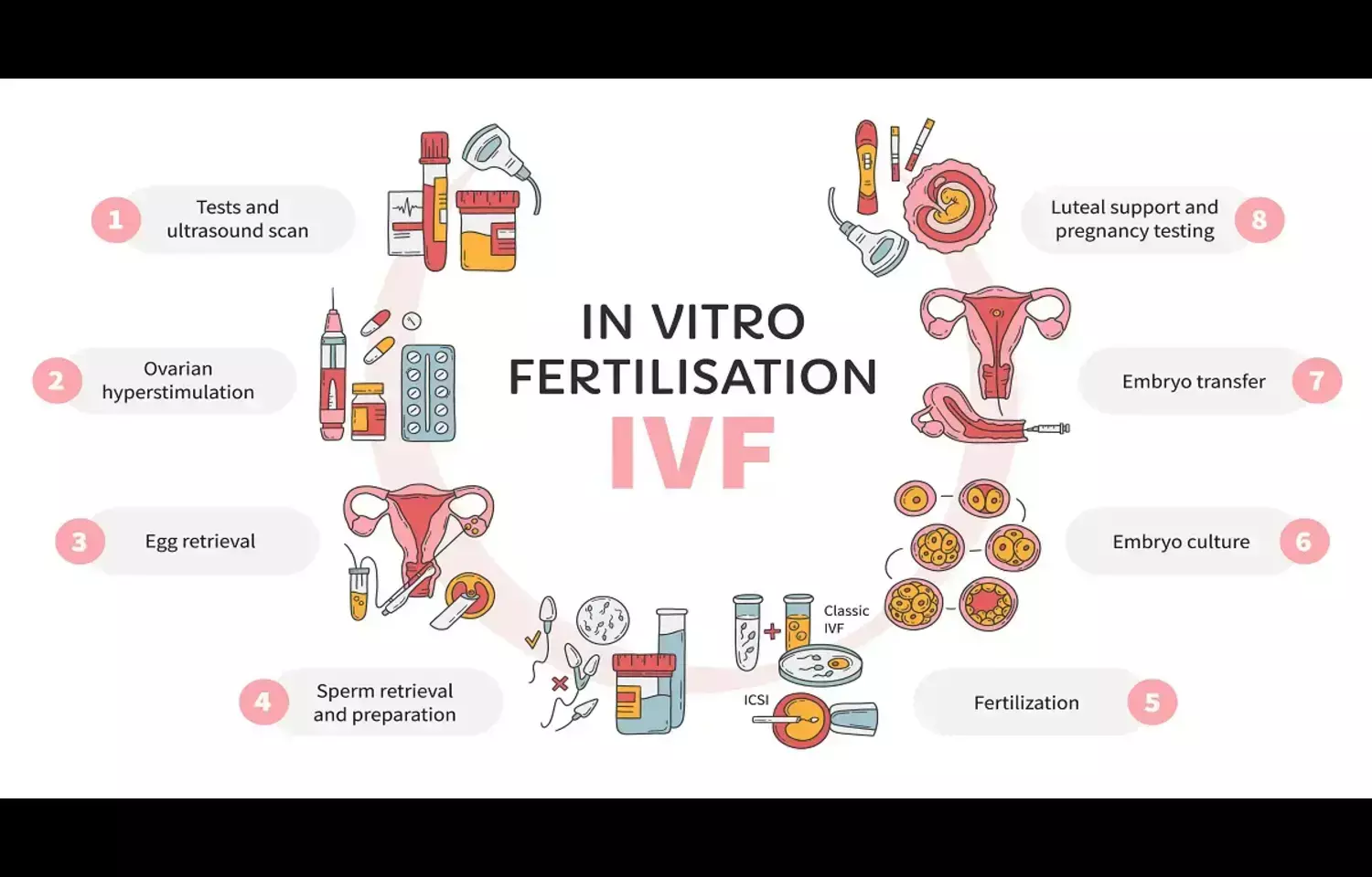 TyG-BMI may predict Adverse Pregnancy Outcomes in IVF, suggests research