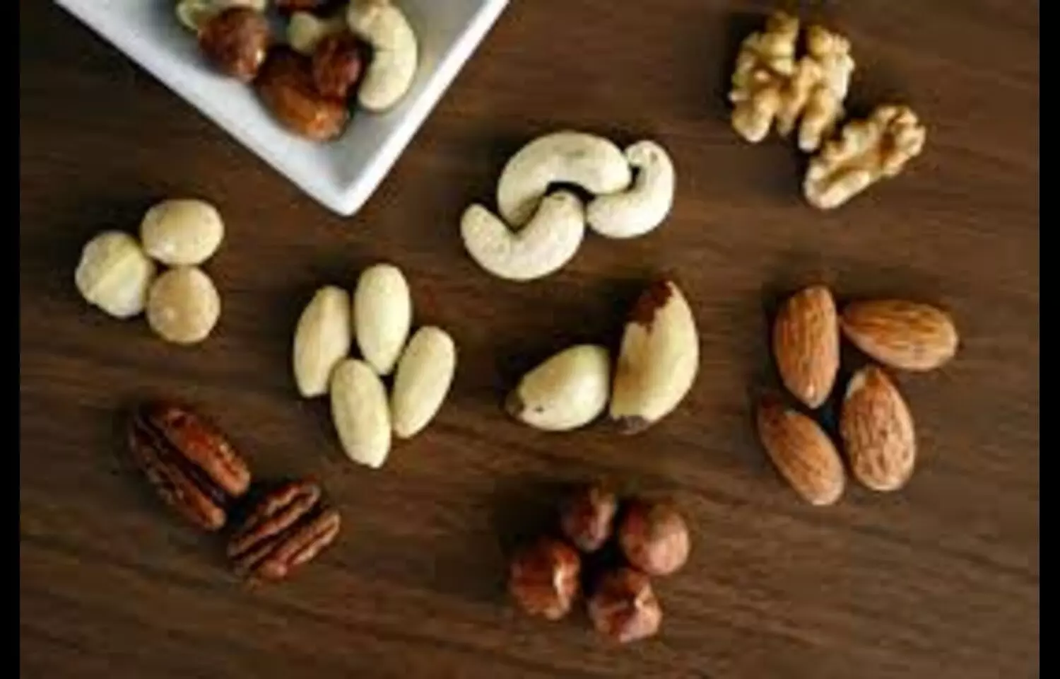 Cashews Now Leading Cause of Tree Nut-Induced Anaphylaxis in Children: Study