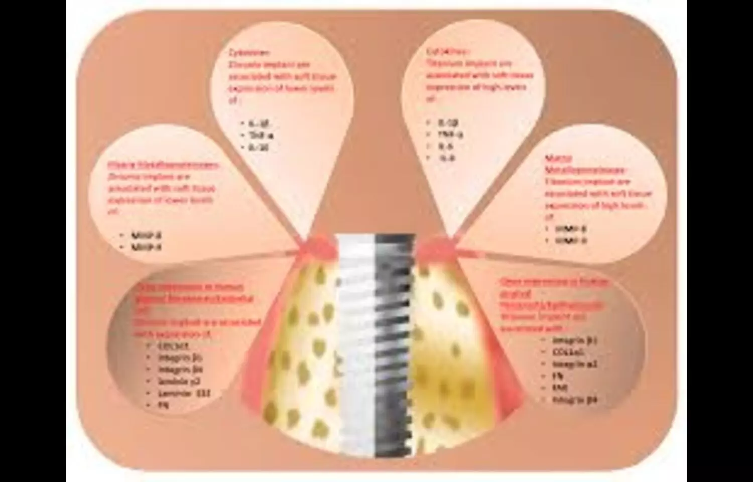 Both Zirconia and Titanium Abutments show comparable Tissue Response and Volume Stability: Study