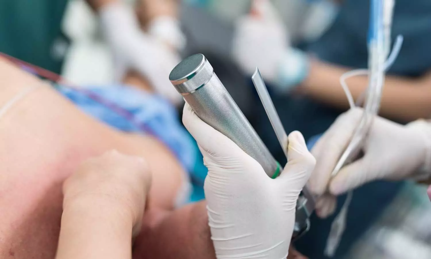 Lignocaine Dilemma: Is Route as Important as Dose in Attenuating Hemodynamic Stress? study finds