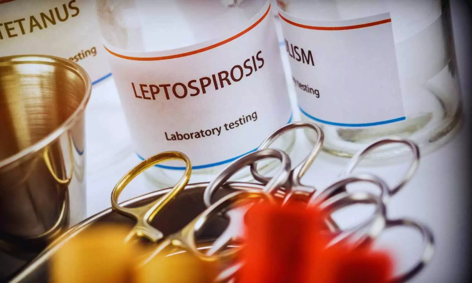 Yale researchers develop novel test for leptospirosis