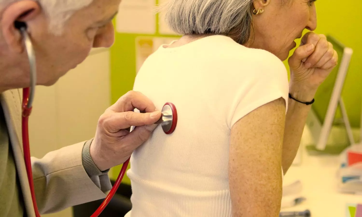 Severe Emphysema on HRCT Signals Higher Heart Disease Risk in COPD Patients: Study