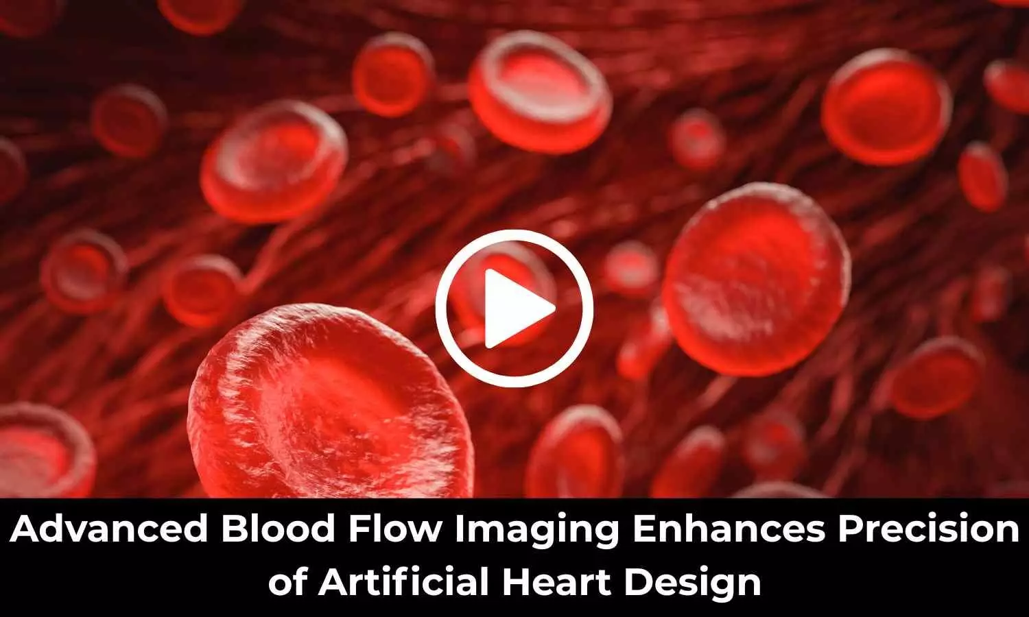 Advanced Blood Flow Imaging Enhances Precision of Artificial Heart Design: Study Shows