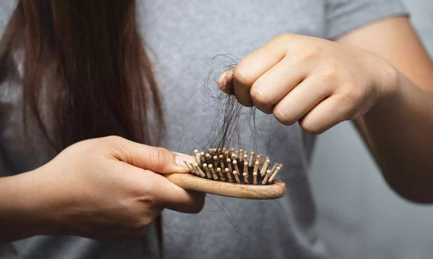 Can a Stevia-derived sweetener improve hair loss treatment?