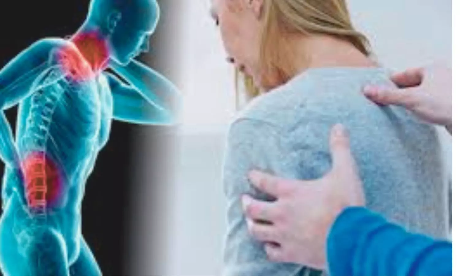 Sarilumab Plus Short Steroid Taper course Improves Outcomes in Polymyalgia Rheumatica: Lancet